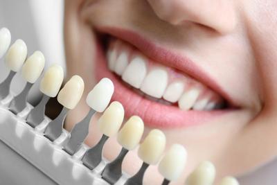 Деминерализация эмали зубов - причины и лечение