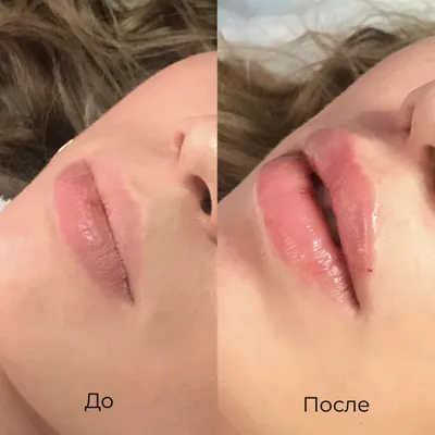 Французские губы: как получить их в домашних условиях без инъекций -  7Дней.ру