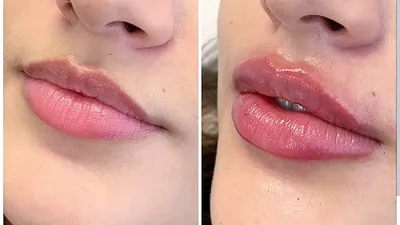 Губы бантиком – французская техника увеличения губ