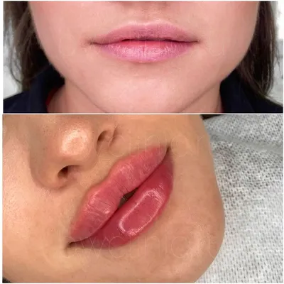 Какие бывают формы губ? – Блог ANACOSMA