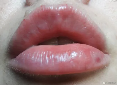 Французские губы»: простая техника увеличения губ без инъекций — попробуйте  дома | MARIECLAIRE