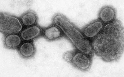Испанский грипп фото вируса фотографии