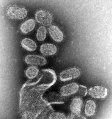 Пандемия \"испанки\" в 1918-м: вирус, поразивший треть человечества
