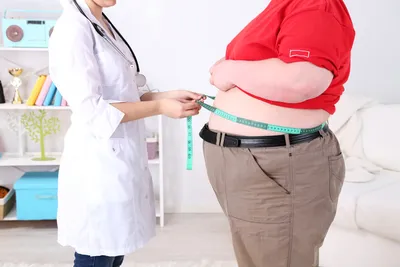 Минздрав США сообщил о пике эпидемии ожирения в стране | Новости  Приднестровья