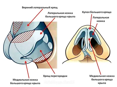 Коррекция носа филлерами в Минске | Безоперационная ринопластика