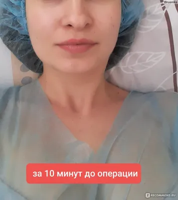 Пластическая хирургия в Минске - ShineEst - Удачная ринопластика Кети  Топурии. 😳👍 ✴️ Певица Кети Топурия не скрывает того, что была не очень  довольна своим крупным носом. Правда, звезда немного лукавит, когда