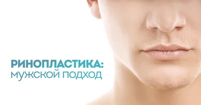 Пластика носа | БЕЗ БОЛИ И УКОЛОВ | Ринопластика в Минске