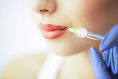 Побочные эффекты от увеличения губ: пошла сыпь по лицу после процедуры у  частного косметолога - 6 июля 2022 - НГС.ру