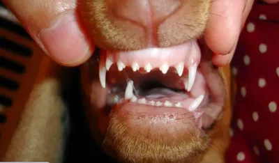 Красивые зубки немецкой ОВЧАРКИ - YouTube